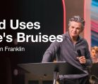 God Uses Life’s Bruises | Jentezen Franklin