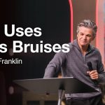 God Uses Life’s Bruises | Jentezen Franklin